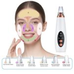 Blackhead Remover Vacuum - Image 2